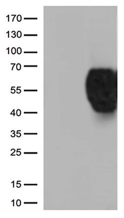 BTLA Monoclonal Antibody (OTI2H5), TrueMAB , OriGene 100 &mu;L; Unconjugated:Antibodies,