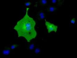 BTN1A1 Monoclonal Antibody (OTI5E6), TrueMAB , OriGene 100 &mu;L; Unconjugated:Antibodies,
