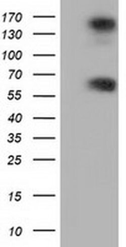 BTN1A1 Monoclonal Antibody (OTI4H2), TrueMAB , OriGene:Antibodies:Primary