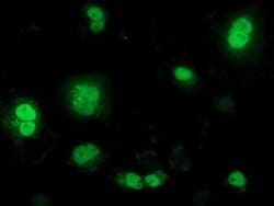 BTRC Mouse anti-Human, Clone: OTI3D5, lyophilized, TrueMAB 100 &mu;g; Unconjugated:Antibodies,