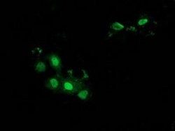 BTRC Monoclonal Antibody (OTI1A4), TrueMAB , OriGene:Antibodies:Primary