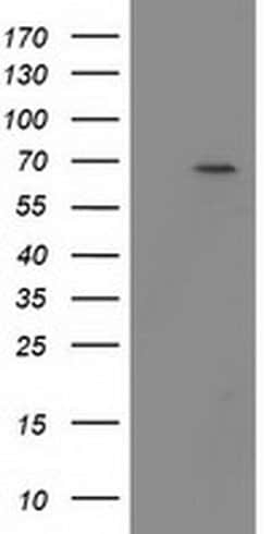 BTRC Monoclonal Antibody (OTI3D5), TrueMAB , OriGene 30 &mu;L; Unconjugated:Antibodies,