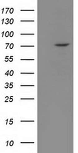 BTRC Monoclonal Antibody (OTI1D4), TrueMAB , OriGene 100 &mu;L; Unconjugated:Antibodies,
