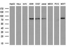 BTRC Monoclonal Antibody (OTI1A4), TrueMAB , OriGene:Antibodies:Primary