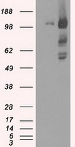 BUB1B Mouse anti-Human, Clone: OTI11G2, liquid, TrueMAB 100 &mu;L; Unconjugated:Antibodies,
