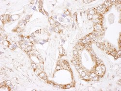 Bcl-2 Rabbit anti-Human, Polyclonal, Bethyl Laboratories 10 &mu;L; Unconjugated:Antibodies,