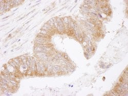 Bcl-2 Rabbit anti-Human, Polyclonal, Bethyl Laboratories 10 &mu;L; Unconjugated:Antibodies,