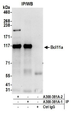 Bcl11a Rabbit anti-Human, Polyclonal, Bethyl Laboratories 100 &mu;L; Unconjugated:Antibodies,