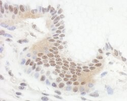 Bcl11b Rabbit anti-Human, Polyclonal, Bethyl Laboratories 100 &mu;L; Unconjugated:Antibodies,