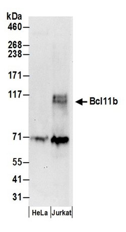 Bcl11b Rabbit anti-Human, Polyclonal, Bethyl Laboratories 100 &mu;L; Unconjugated:Antibodies,