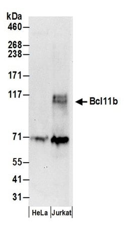 Bcl11b Polyclonal Antibody, Bethyl Laboratories 20 &mu;L; Unconjugated:Antibodies,
