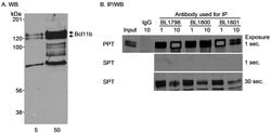 Bcl11b Rabbit anti-Human, Polyclonal, Bethyl Laboratories 100 &mu;L; Unconjugated:Antibodies,