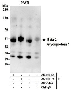Beta-2-Glycoprotein 1 Mouse anti-Human, Clone: 7B8, Bethyl Laboratories
