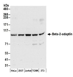 Beta-2-adaptin Polyclonal Antibody, Bethyl Laboratories 20 &mu;L; Unconjugated:Antibodies,
