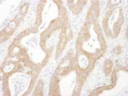 Beta-Arrestin 1 Rabbit anti-Human, Polyclonal, Bethyl Laboratories 100