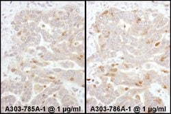 Beta-Arrestin 2 Rabbit anti-Human, Polyclonal, Bethyl Laboratories 10 &mu;L;
