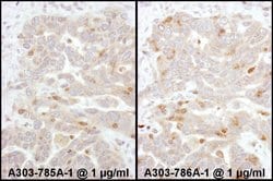 Beta-Arrestin 2 Rabbit anti-Human, Polyclonal, Bethyl Laboratories 100