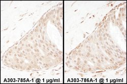 Beta-Arrestin 2 Rabbit anti-Human, Polyclonal, Bethyl Laboratories 100
