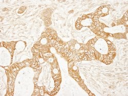 Beta-catenin Rabbit anti-Human, Mouse, Polyclonal, Bethyl Laboratories 100 &mu;L | Buy Online | Bethyl Laboratories, Inc | Fisher Scientific