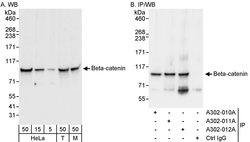 Beta-catenin Rabbit anti-Human, Mouse, Polyclonal, Bethyl Laboratories 100 &mu;L | Buy Online | Bethyl Laboratories, Inc | Fisher Scientific