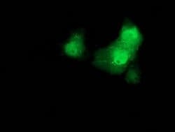 Beta-catenin Monoclonal Antibody (OTI2F6), TrueMAB , OriGene 100 &mu;L;