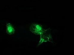 Beta-catenin Monoclonal Antibody (OTI1E10), TrueMAB , OriGene 100 &mu;L;