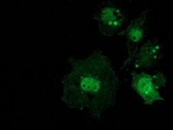 Beta-catenin Monoclonal Antibody (OTI8B5), TrueMAB , OriGene 100 &mu;L;