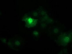 Beta-catenin Monoclonal Antibody (OTI9C1), TrueMAB , OriGene 100 &mu;L;