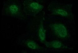 Beta-catenin Monoclonal Antibody (OTI9C1), TrueMAB , OriGene:Antibodies:Primary