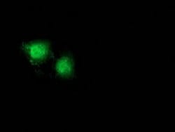 Beta-catenin Monoclonal Antibody (OTI9F6), TrueMAB , OriGene 30 &mu;L;
