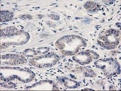 Beta-catenin Monoclonal Antibody (OTI1G1), TrueMAB , OriGene 100 &mu;L;