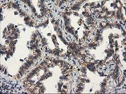 Beta-catenin Monoclonal Antibody (OTI1E10), TrueMAB , OriGene 100 &mu;L;