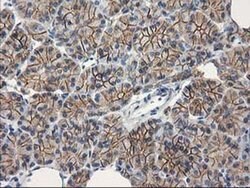 Beta-catenin Monoclonal Antibody (OTI1E10), TrueMAB , OriGene 100 &mu;L;