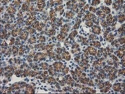 Beta-catenin Monoclonal Antibody (OTI1E10), TrueMAB , OriGene 100 &mu;L;