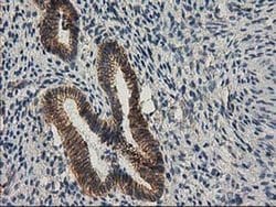 Beta-catenin Monoclonal Antibody (OTI1E10), TrueMAB , OriGene 100 &mu;L;