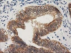 Beta-catenin Monoclonal Antibody (OTI1E10), TrueMAB , OriGene 100 &mu;L;