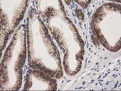 Beta-catenin Monoclonal Antibody (OTI1E10), TrueMAB , OriGene 100 &mu;L;