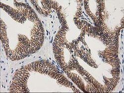 Beta-catenin Monoclonal Antibody (OTI1E10), TrueMAB , OriGene 100 &mu;L;