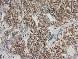 Beta-catenin Monoclonal Antibody (OTI1E10), TrueMAB , OriGene 100 &mu;L;