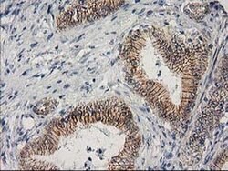 Beta-catenin Monoclonal Antibody (OTI1E10), TrueMAB , OriGene 100 &mu;L;