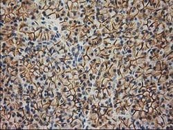 Beta-catenin Monoclonal Antibody (OTI1B11), TrueMAB , OriGene 30 &mu;L;