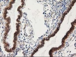 Beta-catenin Monoclonal Antibody (OTI1B11), TrueMAB , OriGene 30 &mu;L;