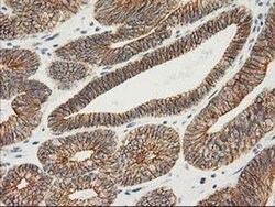 Beta-catenin Monoclonal Antibody (OTI1B11), TrueMAB , OriGene 30 &mu;L;