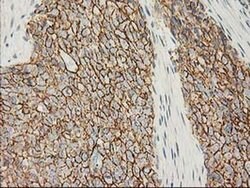 Beta-catenin Monoclonal Antibody (OTI1B11), TrueMAB , OriGene 30 &mu;L;