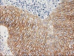 Beta-catenin Monoclonal Antibody (OTI1B11), TrueMAB , OriGene 30 &mu;L;