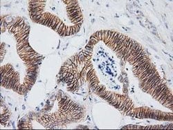 Beta-catenin Monoclonal Antibody (OTI1B11), TrueMAB , OriGene 30 &mu;L;