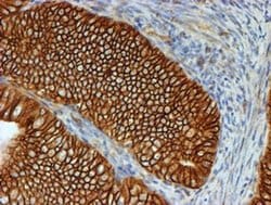 Beta-catenin Monoclonal Antibody (OTI3F9), TrueMAB , OriGene 100 &mu;L;
