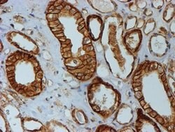 Beta-catenin Monoclonal Antibody (OTI3F9), TrueMAB , OriGene 100 &mu;L;