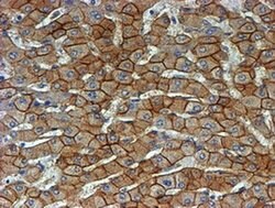Beta-catenin Monoclonal Antibody (OTI3F9), TrueMAB , OriGene 100 &mu;L;