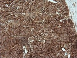 Beta-catenin Monoclonal Antibody (OTI9C1), TrueMAB , OriGene 100 &mu;L;